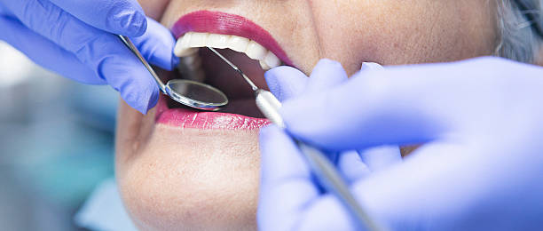 Best Emergency Wisdom Teeth Removal in Line Acres, MO